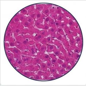 Analise toxicologica de figado